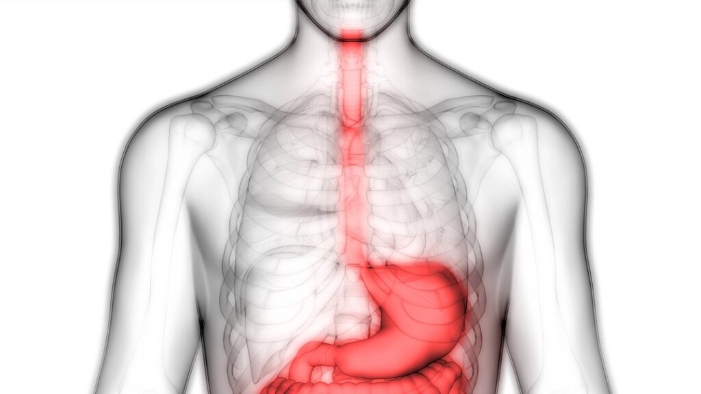 Barrett's Esophagus Explained