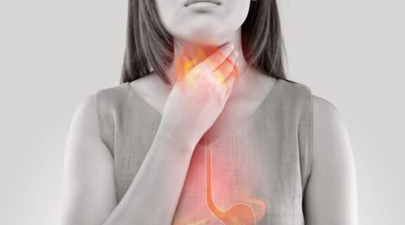 Heartburn and Acid Reflux: What’s the Difference?