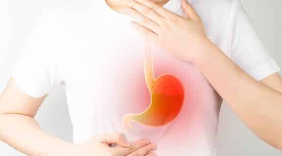 Acid Reflux: Understanding Causes, Consequences, and Testing 