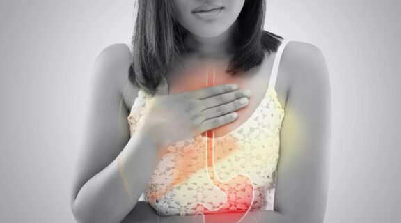 What is Silent Acid Reflux?